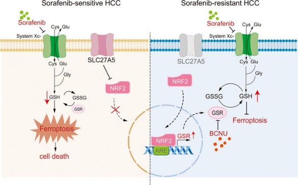 Proposed mechanistic model of sorafenib resistance caused by SLC27A5 deficiency.jpg